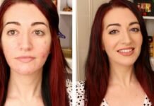 Scrutinizes for Best Makeup for Acne Prone Skin