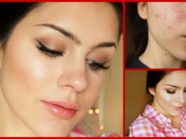 Which is the Best Makeup for Acne Prone Skin